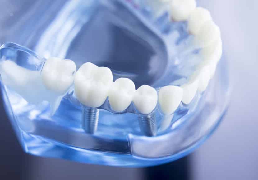 dental teeth dentistry model
